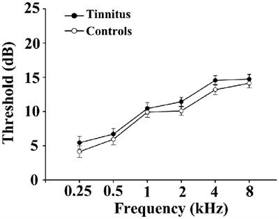 Increased Resting-State Cerebellar-Cerebral Functional Connectivity Underlying Chronic Tinnitus